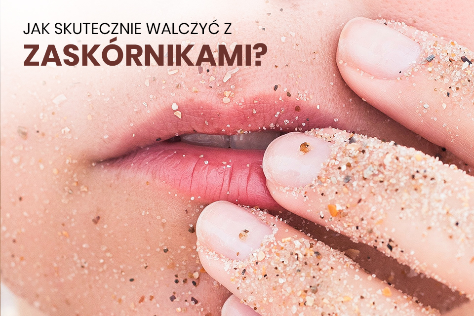 Jak skutecznie walczyć z zaskórnikami?