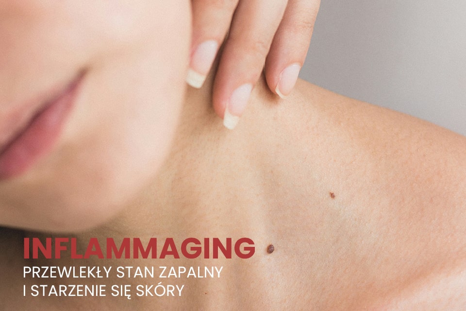 inflammaging przewlekły stan zapalny skóry