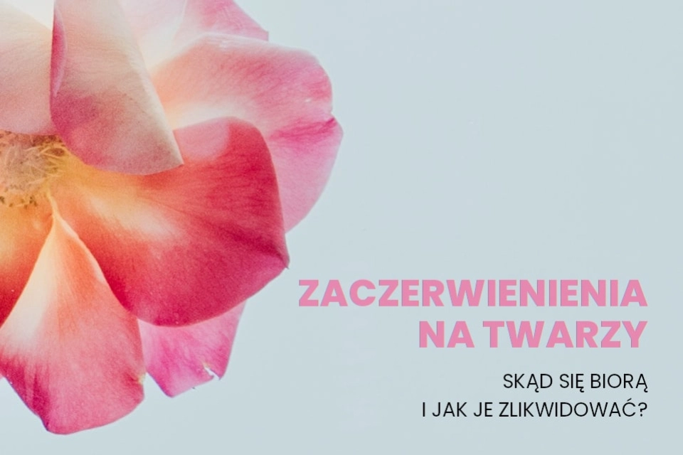 Zaczerwienienia na twarzy - skąd się biorą i jak je zlikwidować?