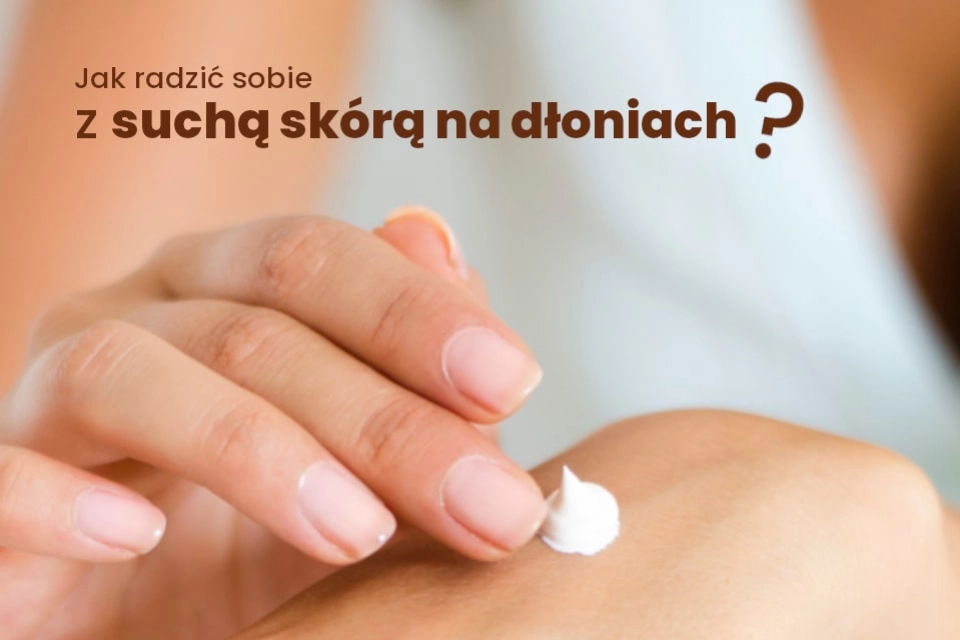 Jak radzić sobie z suchą skórą na dłoniach?