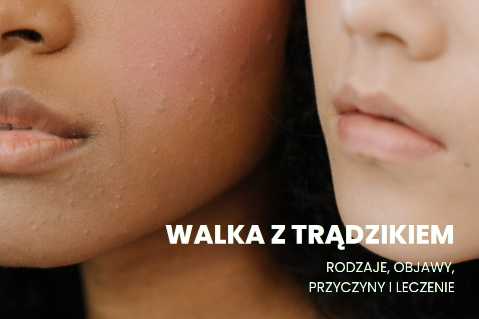 Walka z trądzikiem - rodzaje trądziku, jego objawy, przyczyny i leczenie